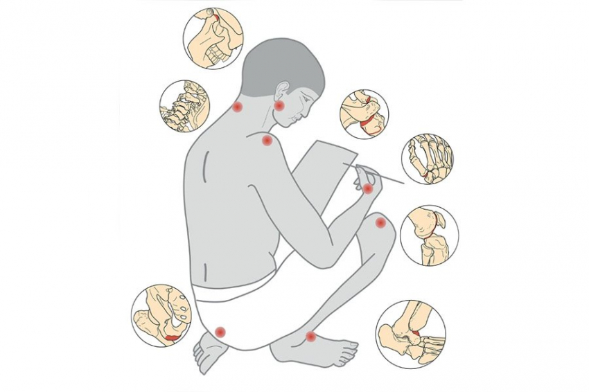 Сидячая работа приводила к изменениям скелета у древнеегипетских писцов 