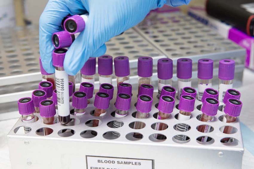Озвучена самая опасная для здоровья группа крови