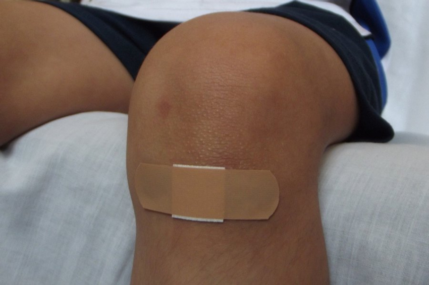 Генерирующие электрический заряд хирургические швы могут ускорить заживление ран