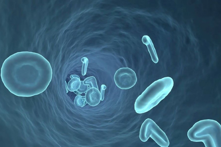 Ученые выявили связь между экземой и заболеваниями сосудов