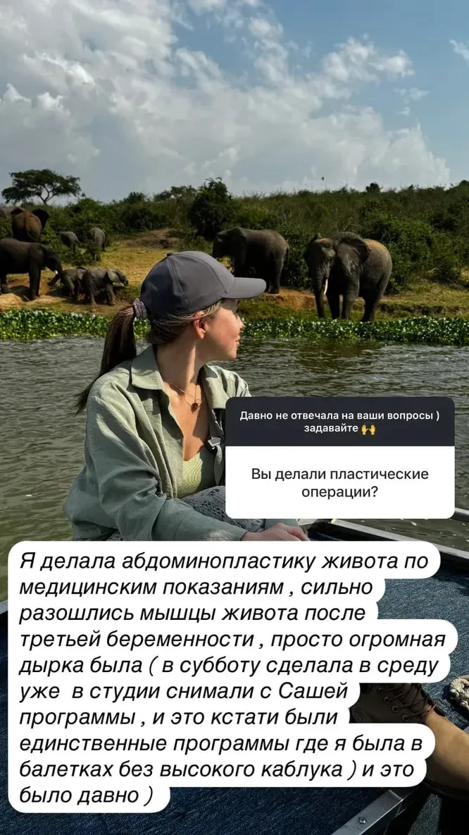 "Огромная дырка была". Юлия Барановская рассказала, что делала пластическую операцию