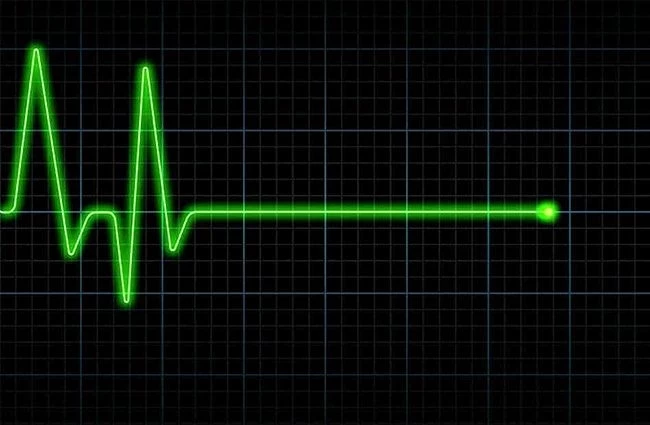 Исследователи раскрыли тайны последних мгновений жизни