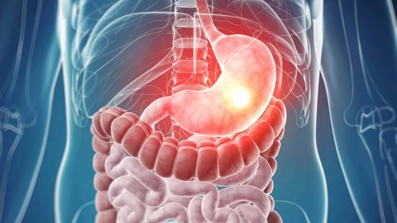 Причины желудочно-кишечного кровотечения: что стоит знать каждому