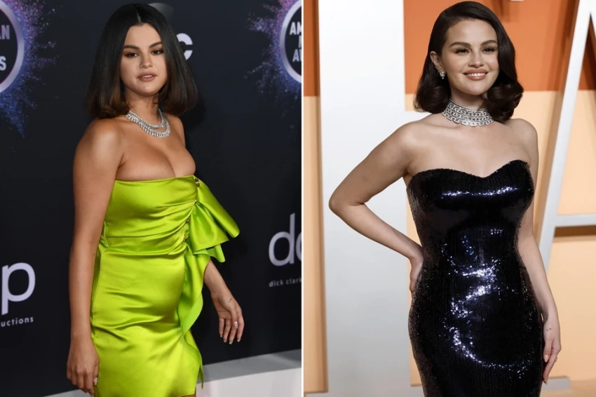 Похудевшие на уколах стройности звезды напугали фанатов на церемонии «Оскара»: парад тощих артисток со «спичками» вместо рук